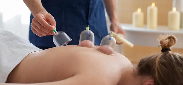 Dry Cupping Therapy